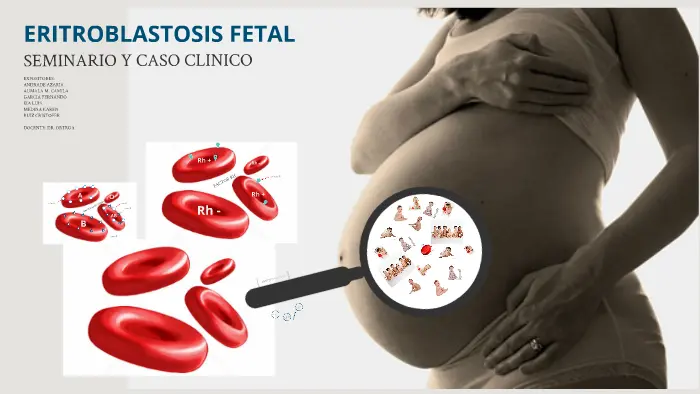 Eritroblastosis Fetal: Causas, Diagnóstico y Tratamiento - Qué es la eritroblastosis fetal y por qué se produce eritroblastosis fetal - Qué es la eritroblastosis fetal y por qué se produce