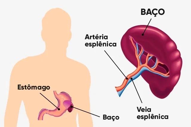 Esplenectomía: Qué es, por qué se realiza y qué esperar - Qué es la esplenectomía esplenectomia - Qué es la esplenectomía