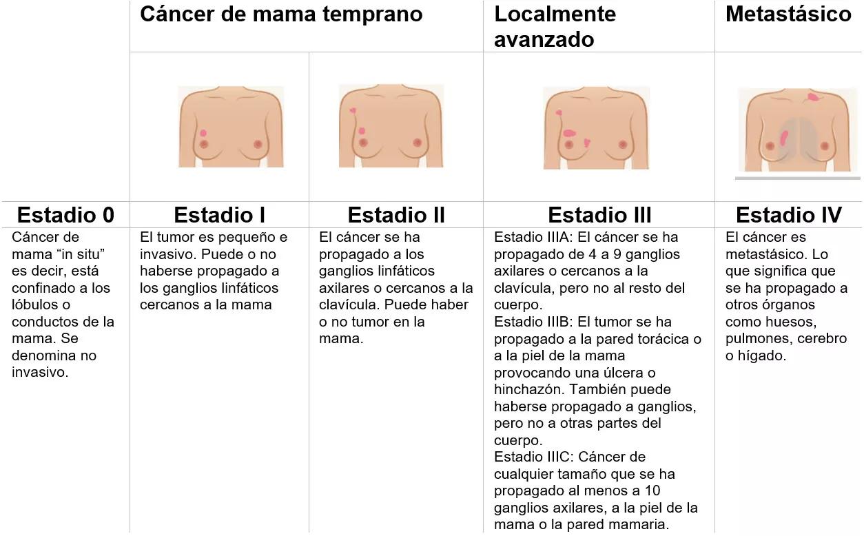Estadificación del Cáncer de Mama: Una Guía Completa - Qué es la estadificación del cáncer de mama estadificacion cancer de mama - Qué es la estadificación del cáncer de mama