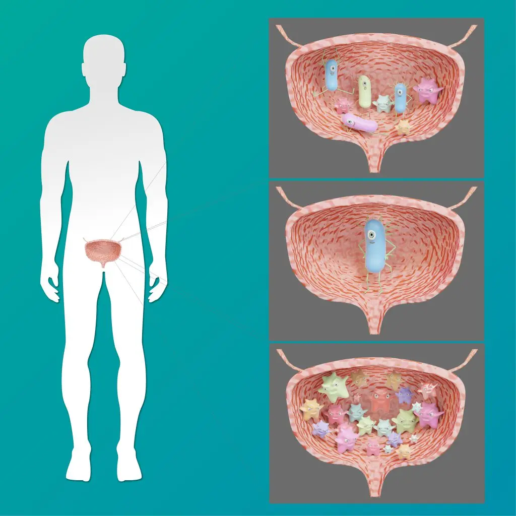 Asintomático: ¿Qué Significa Y Cuándo Preocuparse? | Doctor Online
