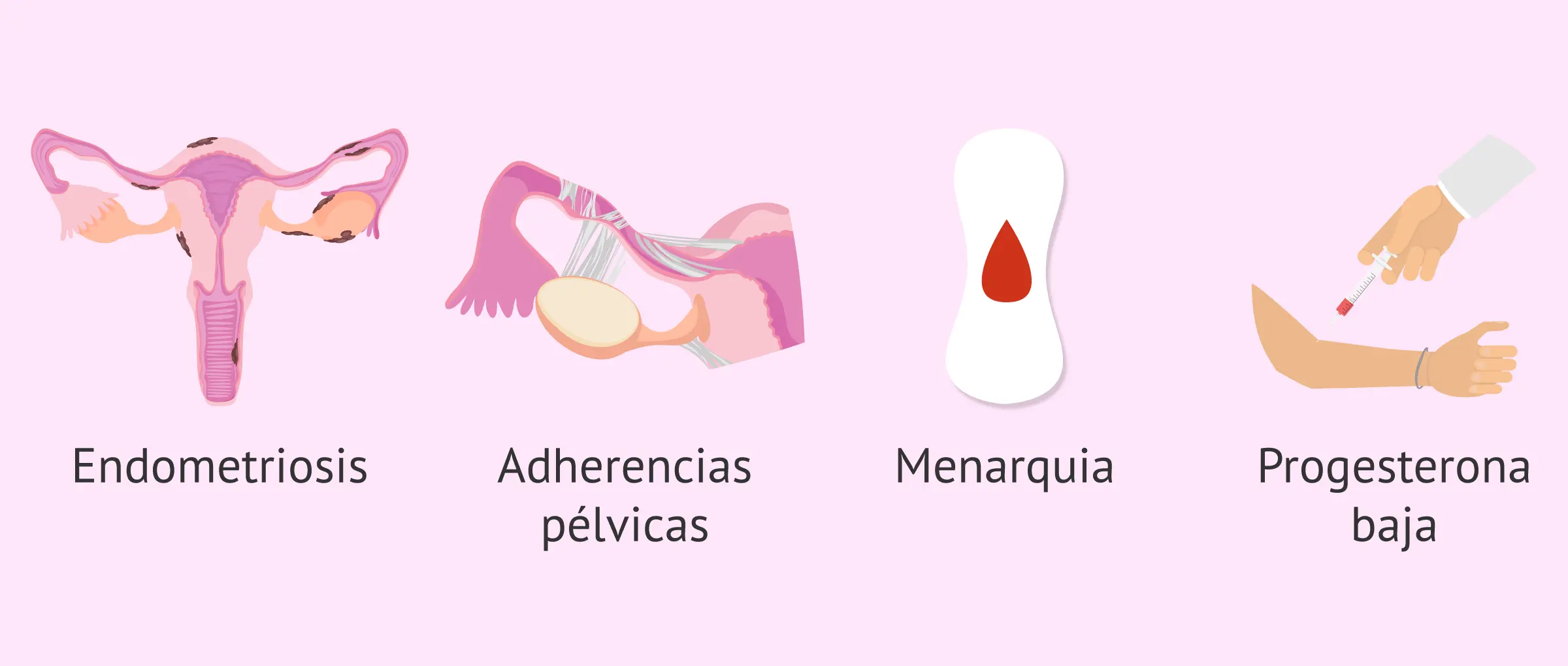 Polihipermenorrea: Una mirada profunda a la menstruación abundante - Qué es la hiperpolimenorrea polihipermenorrea - Qué es la hiperpolimenorrea