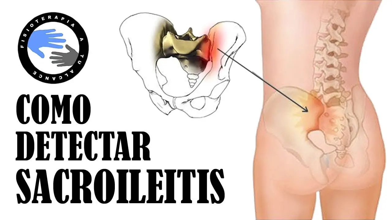 Dolor Lumbar Derecho y Cadera: Causas, Síntomas y Tratamiento - Qué es la lumbalgia de cadera dolor lumbar derecho y cadera - Qué es la lumbalgia de cadera