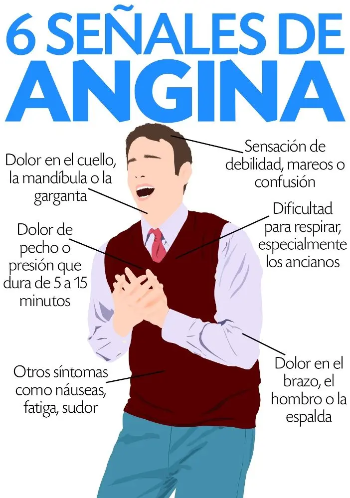 Angina de pecho estable: Conociendo los síntomas y el tratamiento - Qué es lo que provoca la angina de pecho angina estable - Qué es lo que provoca la angina de pecho