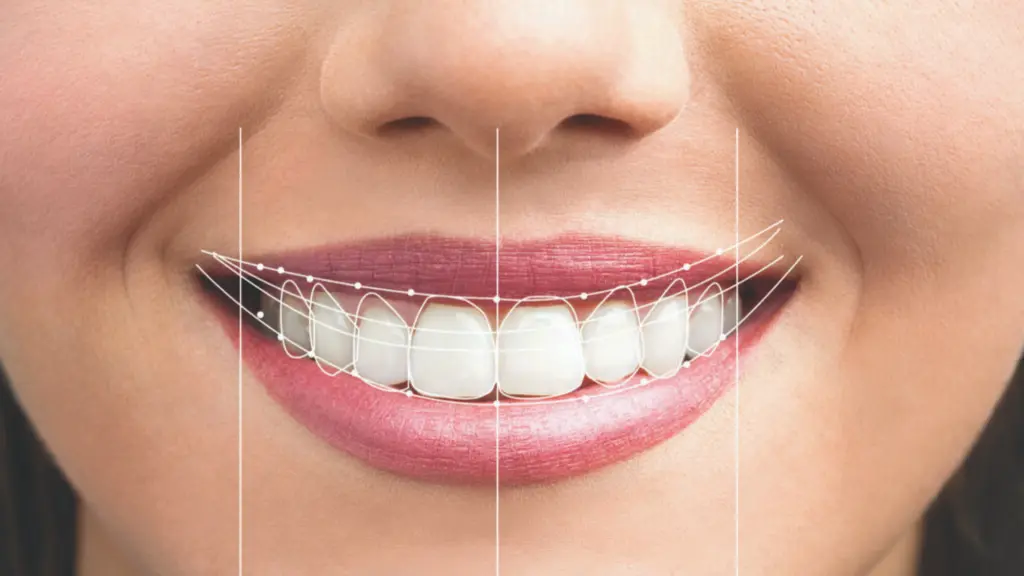 Diagnóstico Dental: Todo lo que necesitas saber - Qué es un diseño dental dental das - Qué es un diseño dental