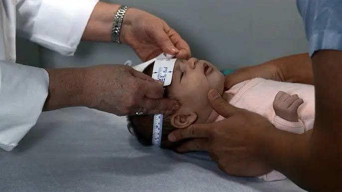 Cefálico: Un término con múltiples significados en salud - Qué es un niño cefálico cefalico - Qué es un niño cefálico