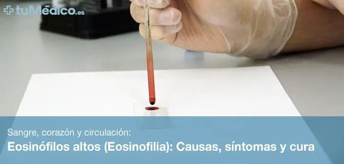 Eosinófilos Altos: ¿Cuándo Preocuparse? - Qué es un nivel alarmante de eosinófilos eosinófilos altos cuando preocuparse - Qué es un nivel alarmante de eosinófilos