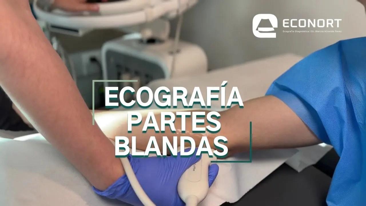 Ecografía de Partes Blandas del Abdomen: Qué es, Para Qué Sirve y Cómo se Realiza - Qué es una ecografía abdominal de partes blandas ecografia partes blandas abdomen - Qué es una ecografía abdominal de partes blandas