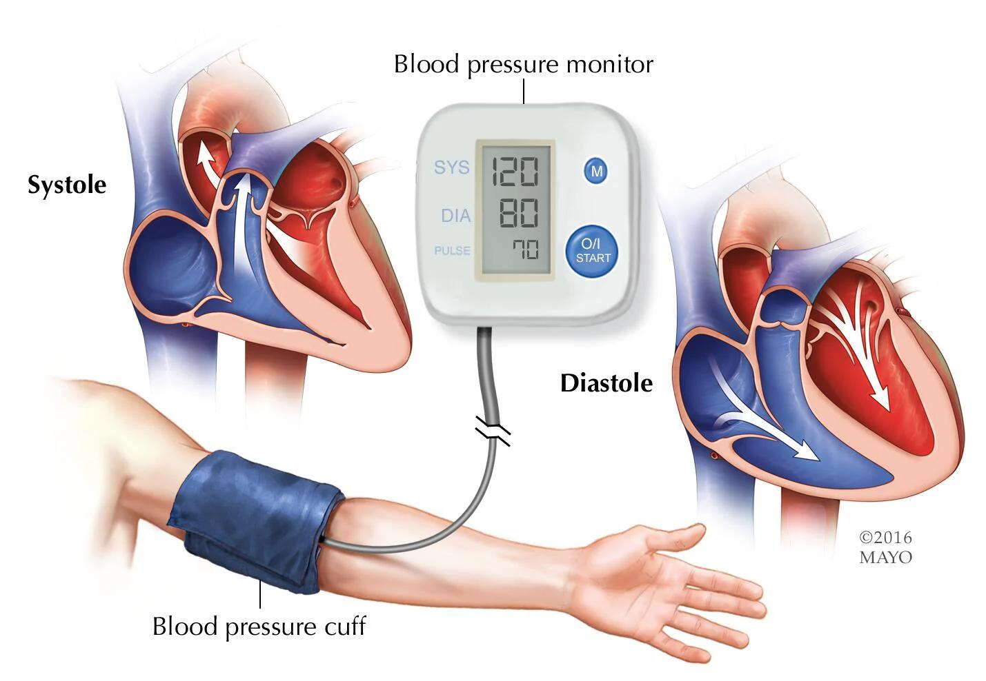 Hipertensión Arterial: Diagnóstico y Pruebas a Realizar - Qué examen se hace para saber si tengo hipertensión hipertensión arterial diagnostico - Qué examen se hace para saber si tengo hipertensión