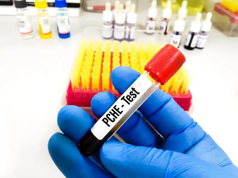 Pseudocolinesterasa: Función, Deficiencia y Niveles Altos - Qué hace la pseudocolinesterasa pseudocolinesterasa - Qué hace la pseudocolinesterasa