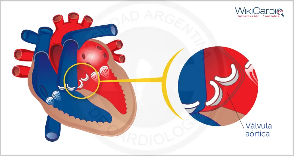 Válvula Aórtica: Función, Enfermedades y Tratamiento - Qué hace la válvula aórtica valvula aortica - Qué hace la válvula aórtica