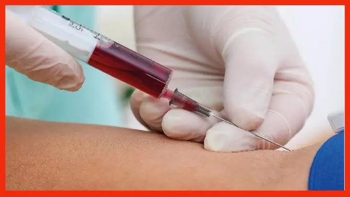 Extracción de Sangre: Tipos, Procedimiento y Cuidados - Qué hacer después de extracción de sangre extraccion de sangre - Qué hacer después de extracción de sangre