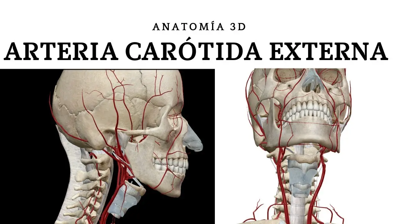Enfermedad de la Arteria Carótida: Diagnóstico, Tratamiento y Prevención - Qué hacer para ayudar a sanar la arteria carótida carotida externa - Qué hacer para ayudar a sanar la arteria carótida