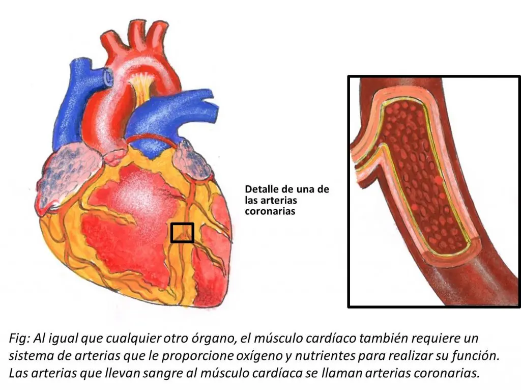 Cardiopatía Isquémica: ¿Es Curable? - Qué hacer si tengo cardiopatía isquémica la cardiopatia isquemica es curable - Qué hacer si tengo cardiopatía isquémica
