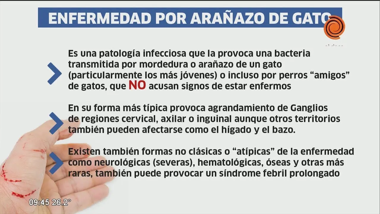 Síntomas de la Enfermedad por Arañazo de Gato: Qué Debes Saber - Qué hago si me rasguña un gato síntomas de enfermedad por arañazo de gato - Qué hago si me rasguña un gato