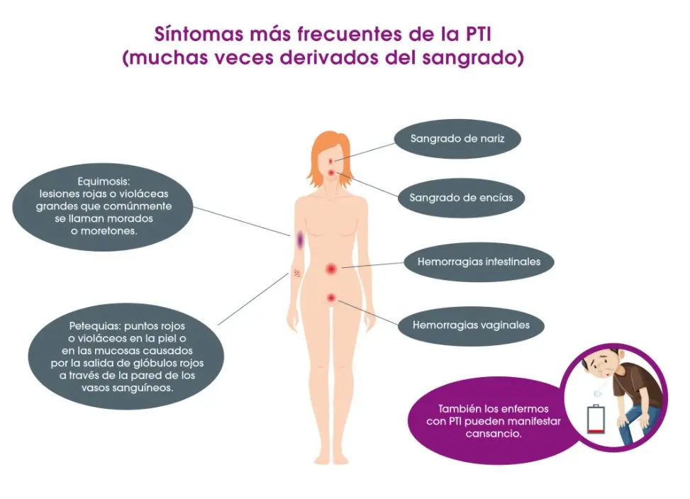 Plaquetas Bajas: Causas, Síntomas y Tratamientos - Qué hay que hacer para que te suban las plaquetas plaquetas bajas causas - Qué hay que hacer para que te suban las plaquetas