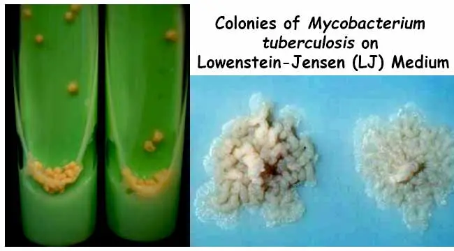 Medio de cultivo Lowenstein Jensen: Una herramienta esencial para el diagnóstico de la tuberculosis - Qué inhibe el verde de malaquita lowenstein jensen - Qué inhibe el verde de malaquita