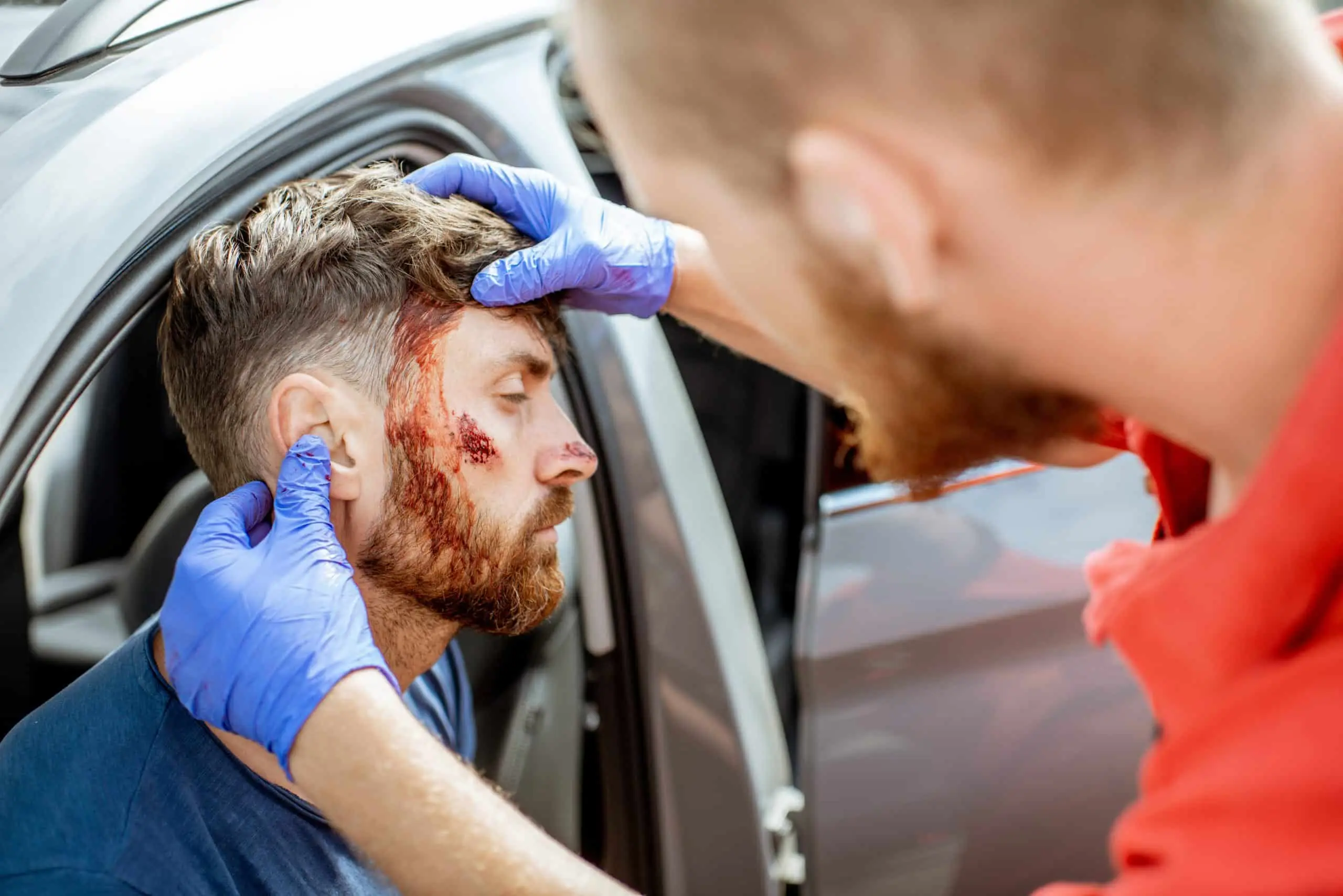 Lesiones por Accidentes: Causas, Tipos y Consecuencias - Qué lesiones se pueden presentar en un accidente de tránsito lesiones por accidente - Qué lesiones se pueden presentar en un accidente de tránsito