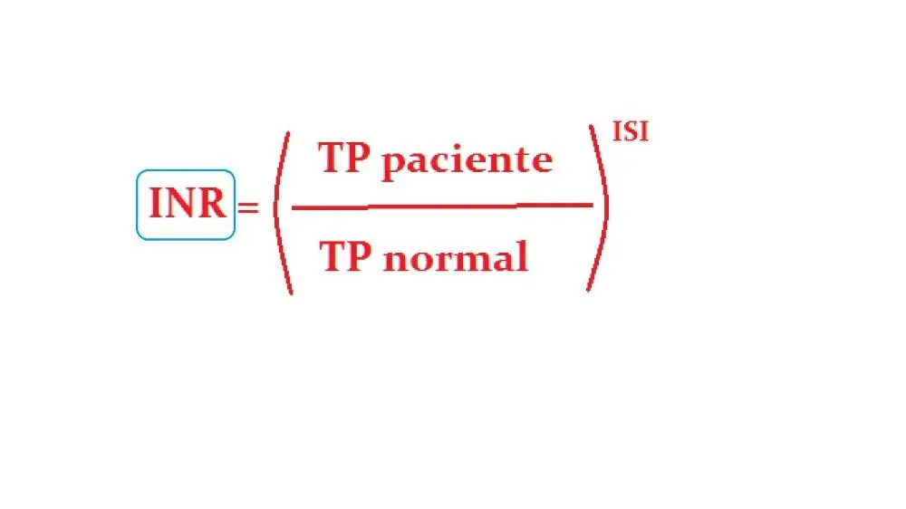 Tiempo de Quick: Todo lo que necesitas saber - Qué mide el tiempo de Quick tiempo de quick - Qué mide el tiempo de Quick