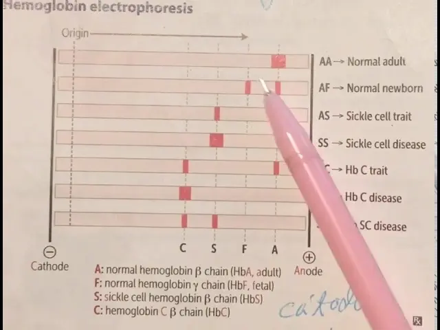Electroforesis de Hemoglobina: Qué es, para qué sirve y cómo se interpreta - Qué mide y detecta la electroforesis electroforesis de hemoglobina - Qué mide y detecta la electroforesis
