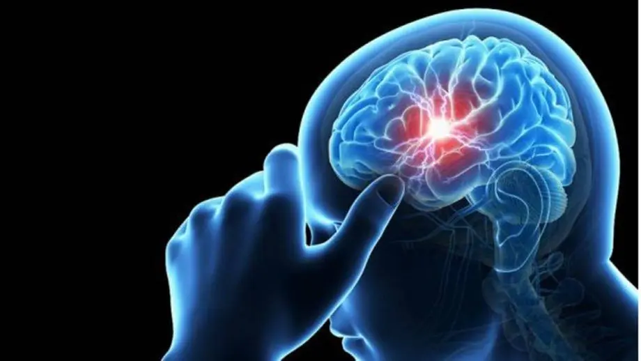 Esperanza de vida tras un aneurisma cerebral: ¿Cómo afecta a la vida del paciente? - Qué no puede hacer una persona con aneurisma esperanza de vida despues de un aneurisma cerebral - Qué no puede hacer una persona con aneurisma