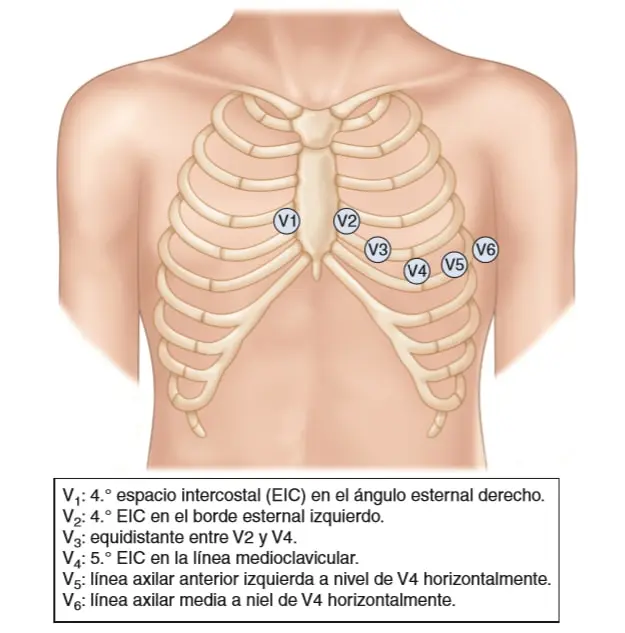 Cómo se realiza un electrocardiograma: Una guía completa - Qué no se debe hacer antes de un electrocardiograma como se hace un electrocardiograma - Qué no se debe hacer antes de un electrocardiograma