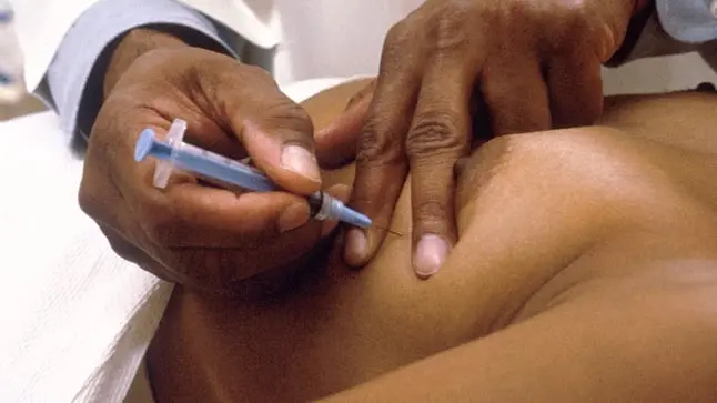 Consecuencias de una biopsia de seno: Lo que debes saber - Qué no se debe hacer después de una biopsia de seno consecuencias de una biopsia de seno - Qué no se debe hacer después de una biopsia de seno