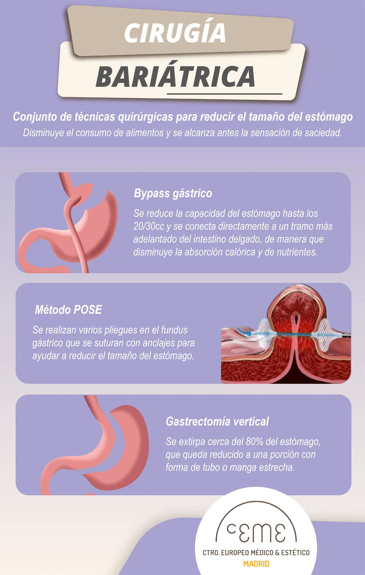 Operaciones de estómago: Tipos, Riesgos y Resultados - Qué operaciones de estómago hay operacion de estomago - Qué operaciones de estómago hay