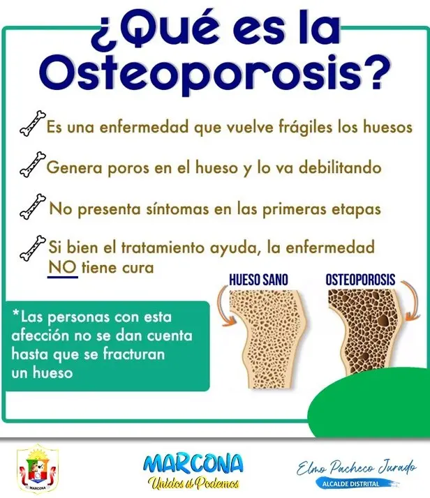 la osteoporosis tiene cura - Qué órganos son los más afectados por la osteoporosis
