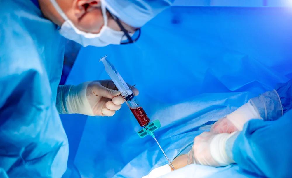 Donación de Médula Ósea: Un Acto de Esperanza y Solidaridad - Qué pasa con el donante de médula ósea trasplante de medula osea - Qué pasa con el donante de médula ósea