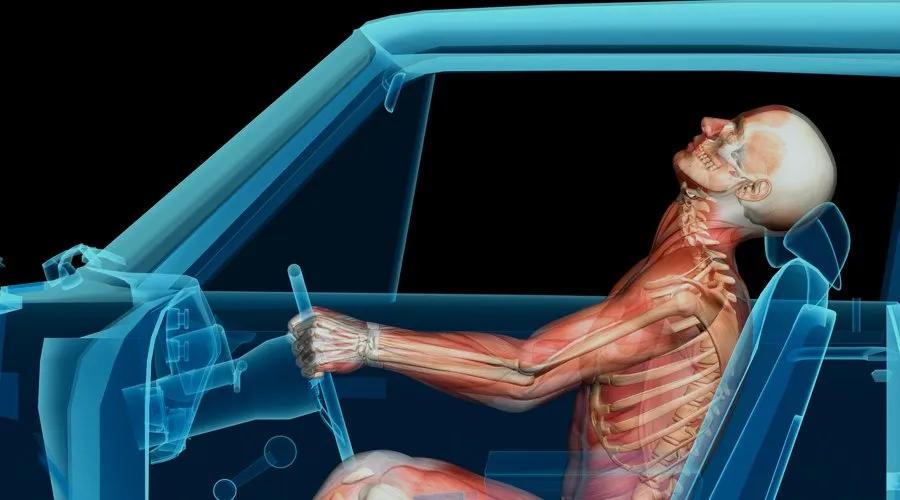 Lesiones por Accidentes: Causas, Tipos y Consecuencias - Qué pasa cuando hay lesionados en un accidente de tránsito lesiones por accidente - Qué pasa cuando hay lesionados en un accidente de tránsito