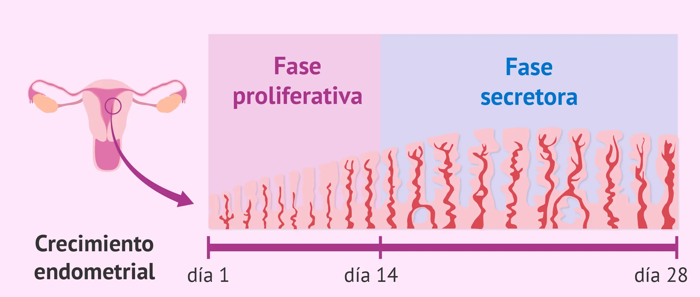 Útero engrosado: Causas, síntomas y qué significa para tu salud - Qué pasa cuando las paredes del útero están gruesas utero engrosado - Qué pasa cuando las paredes del útero están gruesas
