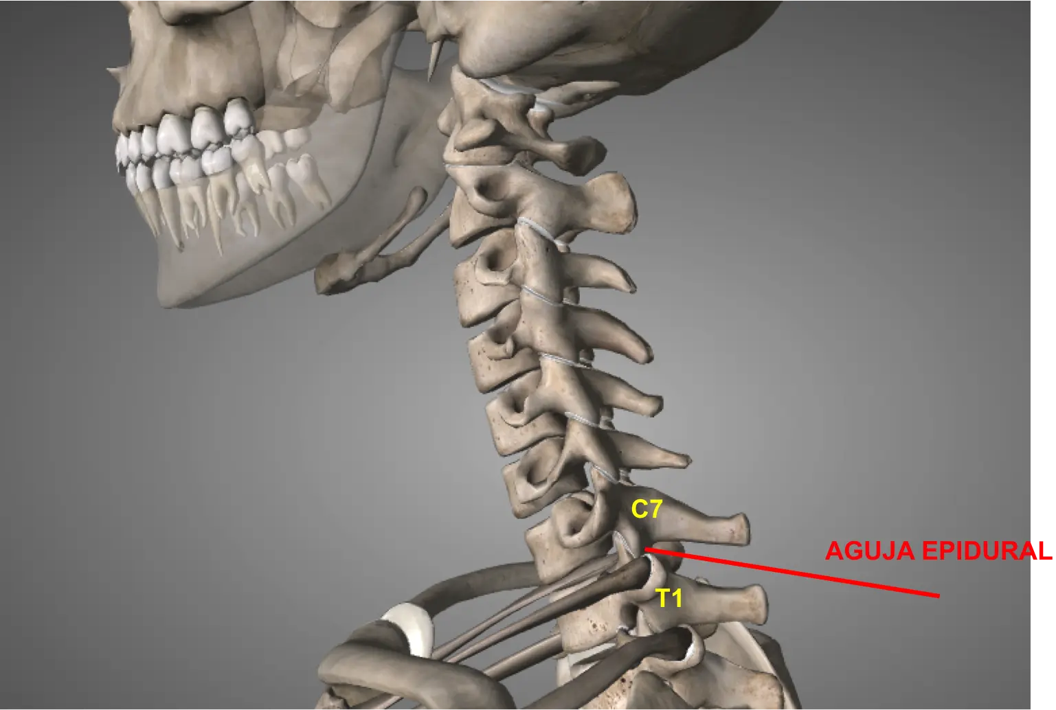Bloqueo Cervical: Riesgos y Posibles Complicaciones - Qué pasa después de un bloqueo cervical bloqueo cervical - Qué pasa después de un bloqueo cervical
