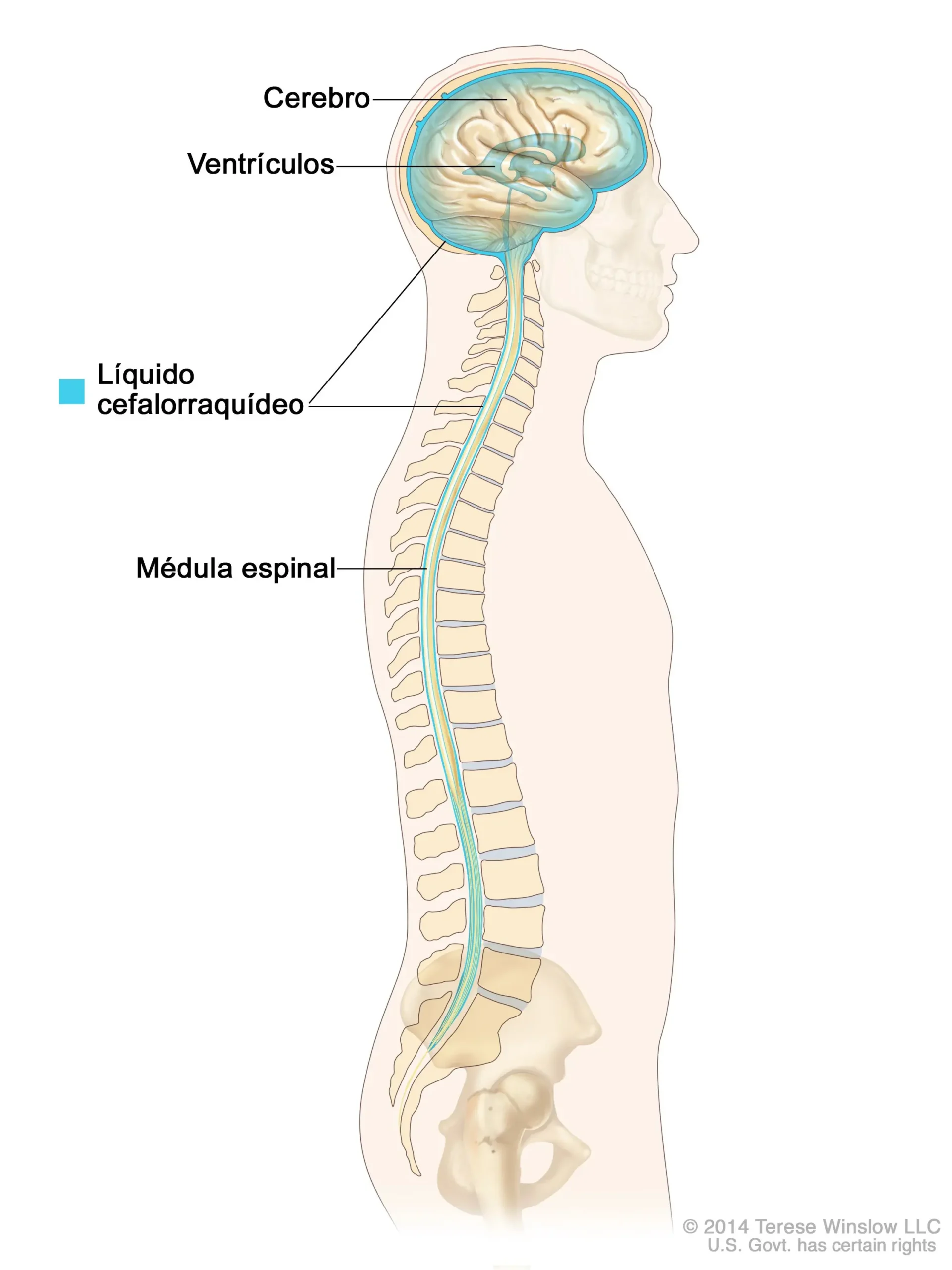 Hidrocefalia: ¿Qué pasa si hay líquido en el cerebro? - Qué pasa si hay líquido en el cerebro liquido en el cerebro - Qué pasa si hay líquido en el cerebro