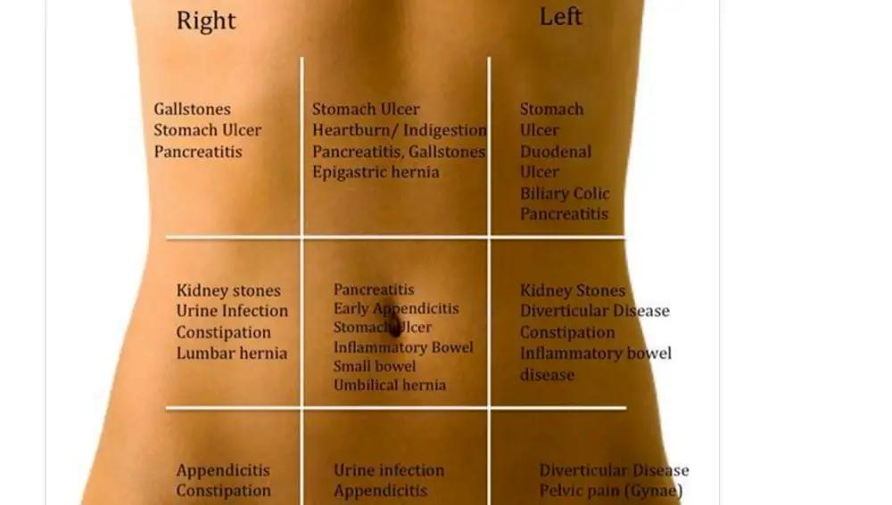 dolor lado derecho abdomen alto - Qué pasa si me duele el lado derecho del abdomen alto
