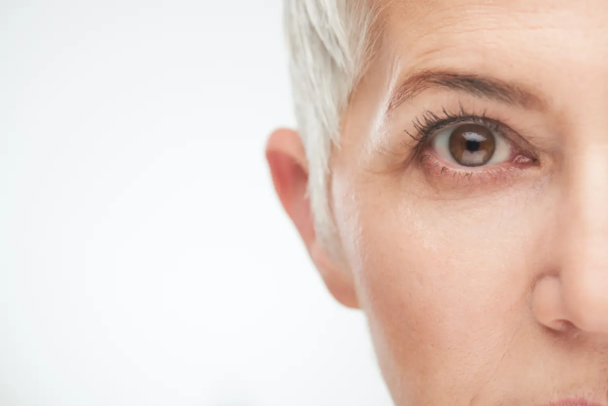 chalazion cirugia - Qué pasa si no me operé un chalazión