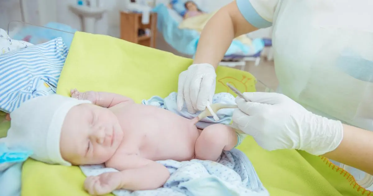 Cuándo se cae el cordón umbilical: Guía completa para padres - Qué pasa si no se le cae el ombligo a mi bebé cuando se cae el cordon umbilical - Qué pasa si no se le cae el ombligo a mi bebé