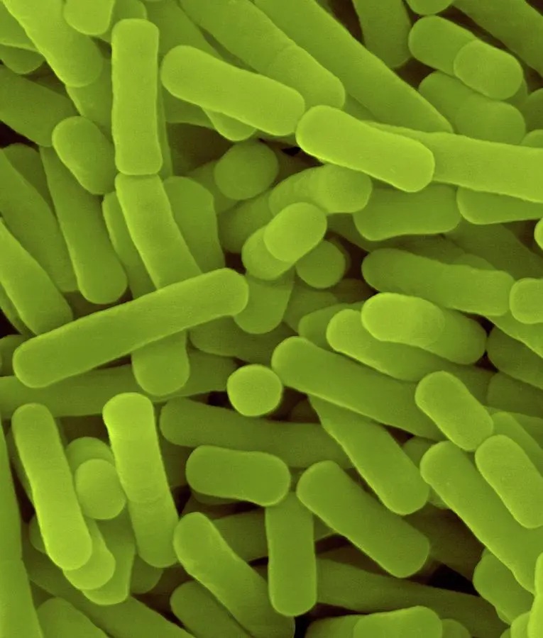 Lactobacillus spp: El aliado esencial para la salud vaginal durante el embarazo - Qué pasa si no tengo Lactobacillus lactobacillus sp - Qué pasa si no tengo Lactobacillus
