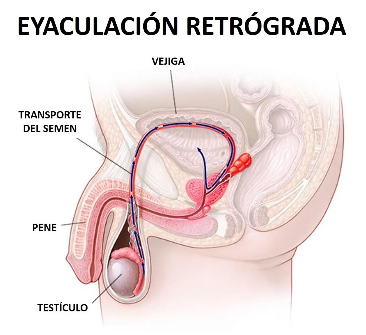 Eyaculación retrógrada: Causas, síntomas y tratamiento - Qué pasa si se retiene la eyaculación eyaculacion retrograda - Qué pasa si se retiene la eyaculación