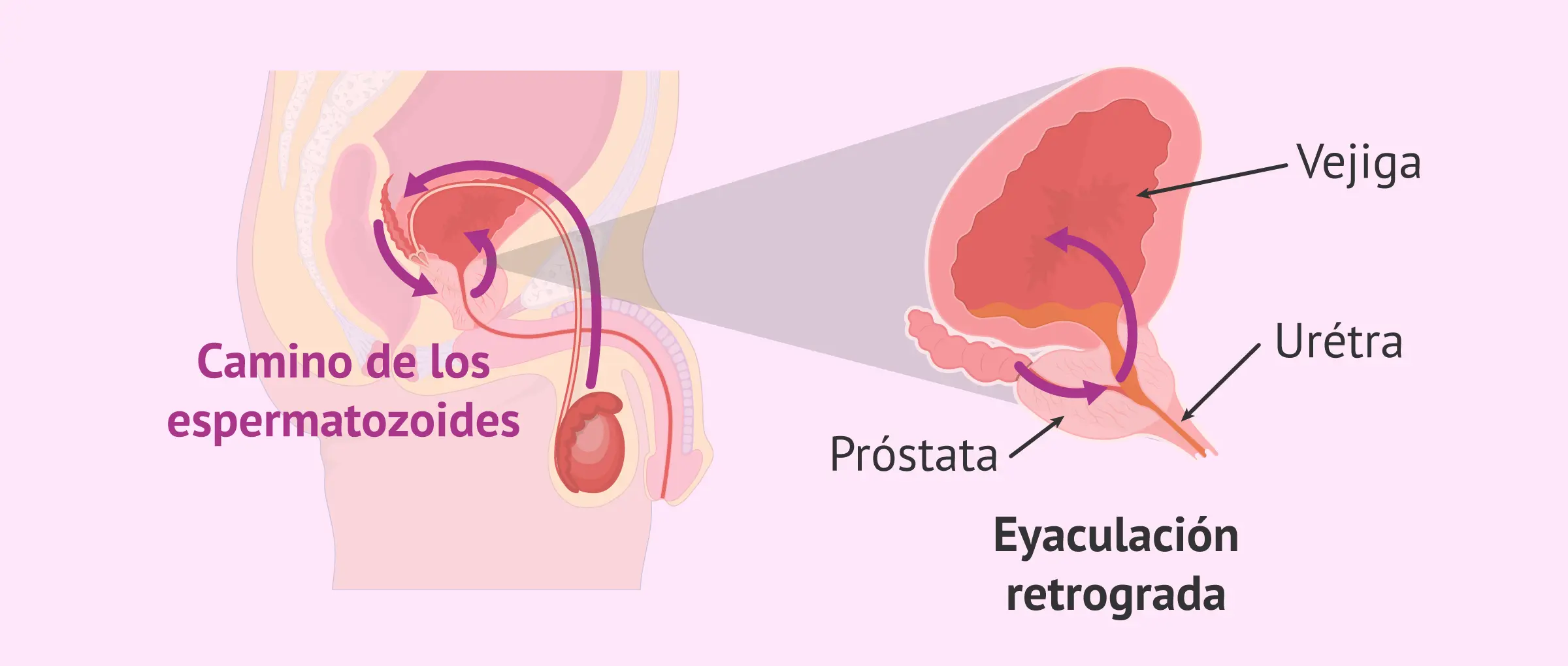 Eyaculación retrógrada: Causas, síntomas y tratamiento - Qué pasa si tengo eyaculación retrógrada eyaculacion retrograda - Qué pasa si tengo eyaculación retrógrada