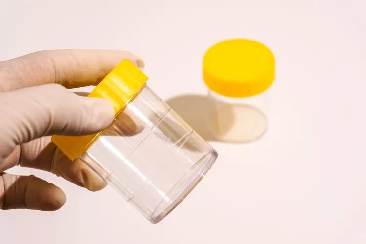 Hemoglobina en Orina: Causas, Síntomas y Diagnóstico - Qué pasa si tengo hemoglobina positiva en la orina hemoglobina en orina - Qué pasa si tengo hemoglobina positiva en la orina
