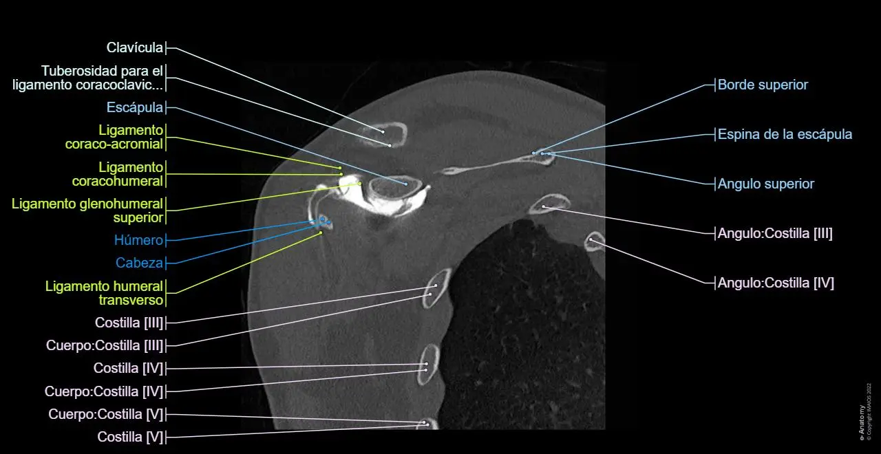 Tomografía de Hombro: Una Guía Completa - Qué pasa si tengo un tumor en el hombro tomografia de hombro - Qué pasa si tengo un tumor en el hombro
