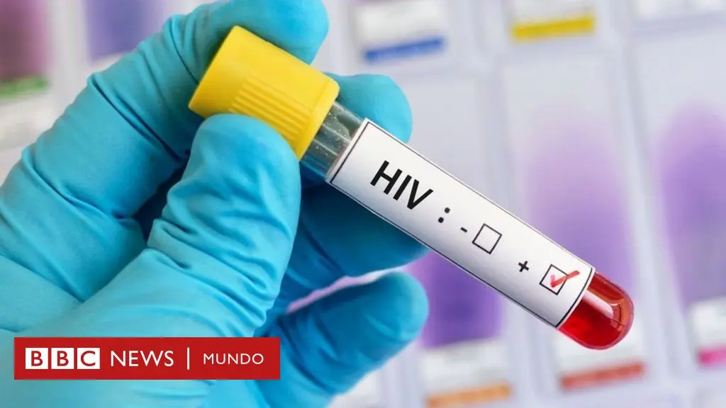 Vacuna contra el VIH: Una esperanza a la vista después de décadas de investigación - Qué pasó con la vacuna VIH vacuna contra el vih - Qué pasó con la vacuna VIH