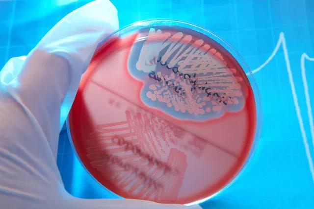 Staphylococcus saprophyticus en orina: Epidemiología, resistencia antimicrobiana y consideraciones terapéuticas - Qué patologías puede causar S. saprophyticus staphylococcus saprophyticus en orina - Qué patologías puede causar S. saprophyticus
