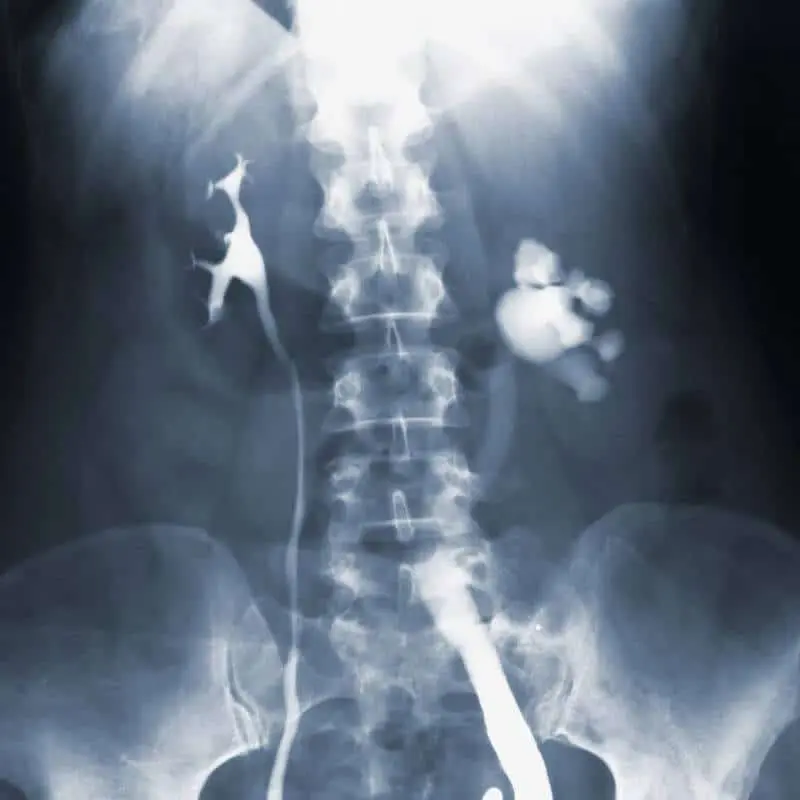 Radiografía de Columna Dorsal: Qué Patologías Detecta y Cómo se Realiza - Qué patologías se pueden observar en una radiografía de columna dorsal radiografia de columna vertebral - Qué patologías se pueden observar en una radiografía de columna dorsal