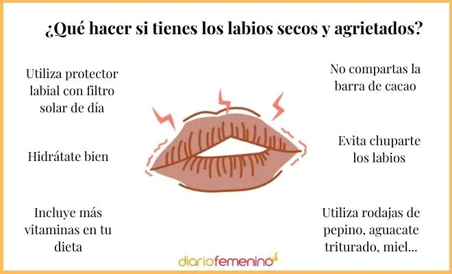 Cómo hidratar los labios secos con remedios caseros: guía completa - Qué ponerse en el labio lastimado labios paspados remedios caseros - Qué ponerse en el labio lastimado