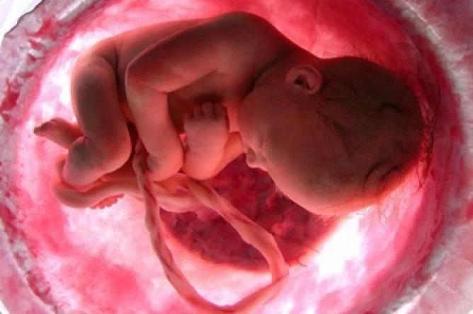 Rotura Prematura de Membranas: Manejo y Complicaciones - Qué porcentaje de embarazos presentan ruptura prematura de membranas rotura prematura de membranas - Qué porcentaje de embarazos presentan ruptura prematura de membranas