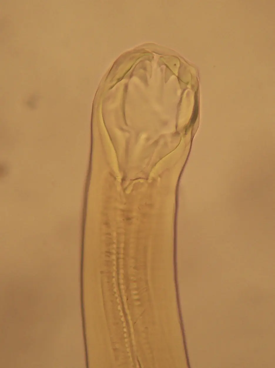 Ancylostoma duodenale: El Gusano Intestinal que Afecta tu Salud - Qué provoca el Ancylostoma caninum ancylostoma duodenale - Qué provoca el Ancylostoma caninum