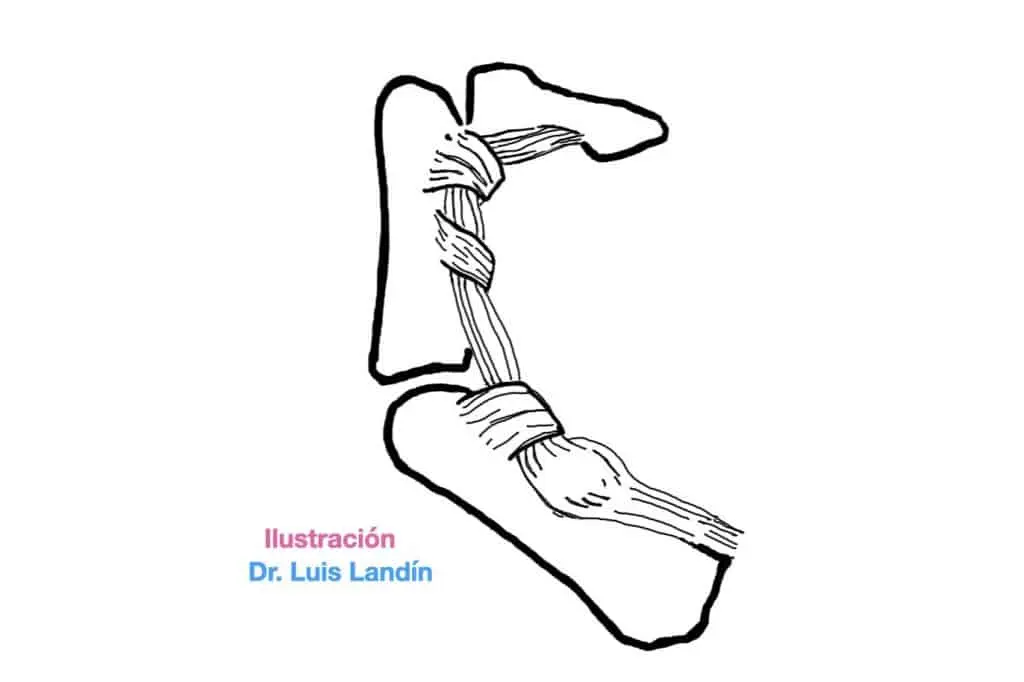 Dedo en Resorte: Causas, Síntomas y Tratamiento - Qué provoca el dedo en resorte dedo pulgar en resorte - Qué provoca el dedo en resorte