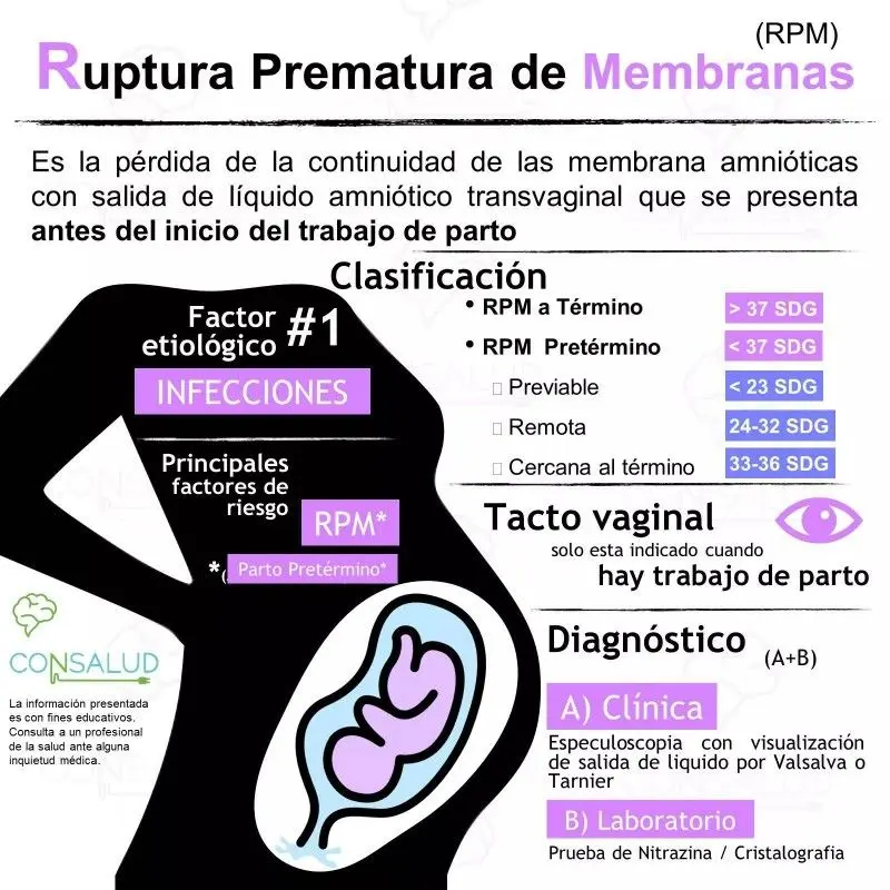 Rotura Prematura de Membranas: Manejo y Complicaciones - Qué provoca la rotura de bolsa rotura prematura de membranas - Qué provoca la rotura de bolsa