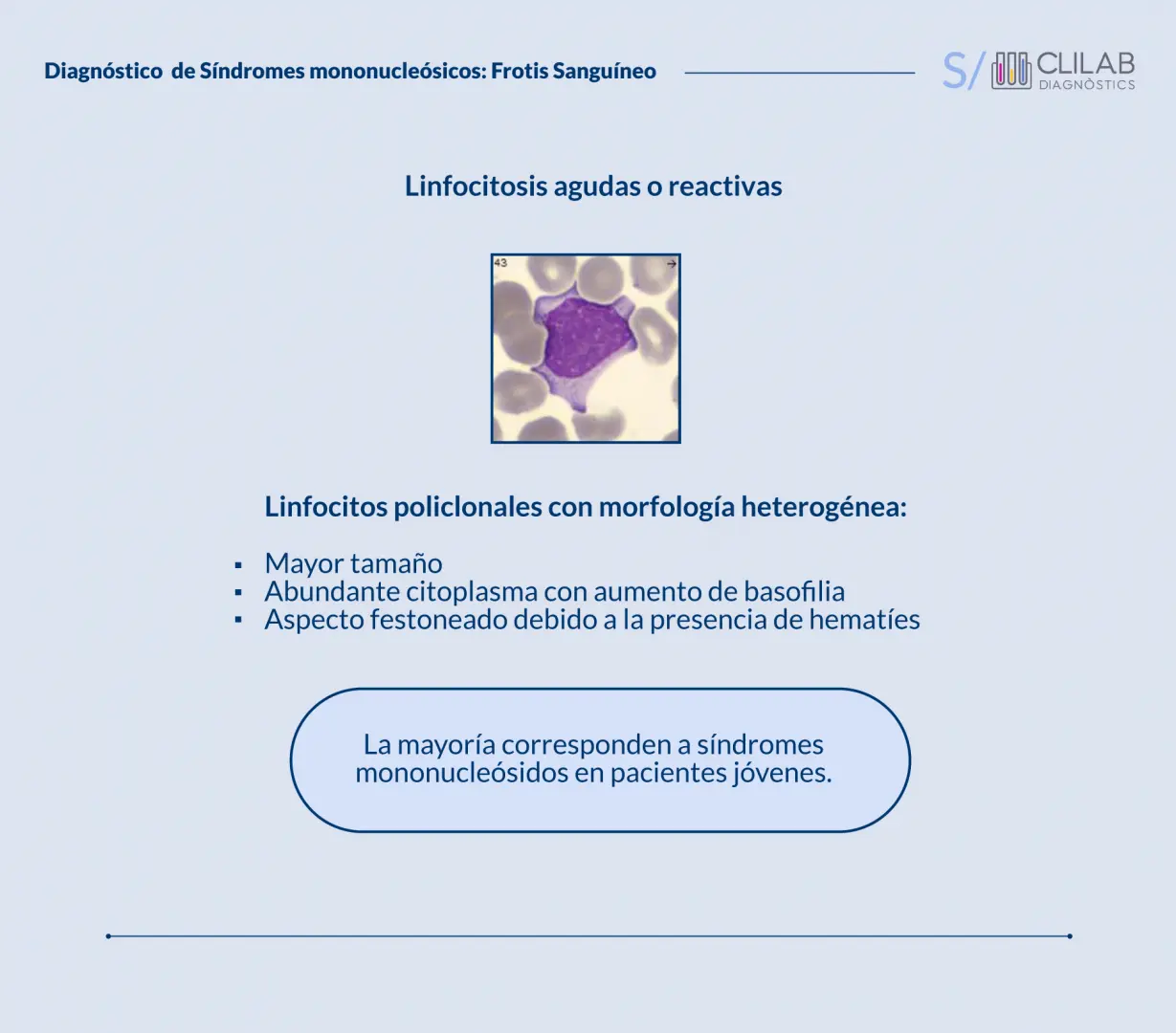 Pruebas de Laboratorio para la Mononucleosis Infecciosa: Una Guía Completa - Qué pruebas de laboratorio son anormales en la mononucleosis mononucleosis infecciosa laboratorio - Qué pruebas de laboratorio son anormales en la mononucleosis